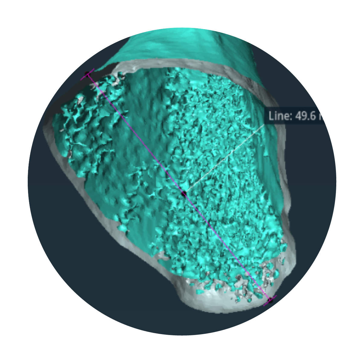 Precision CT Scan