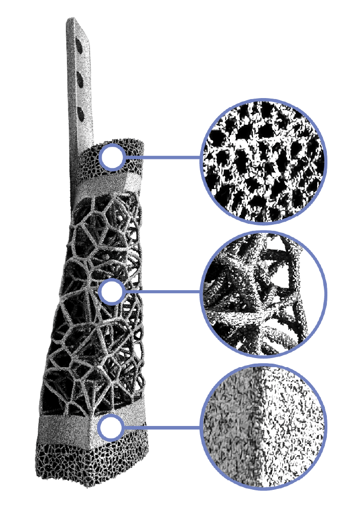 SolidWorks implant design