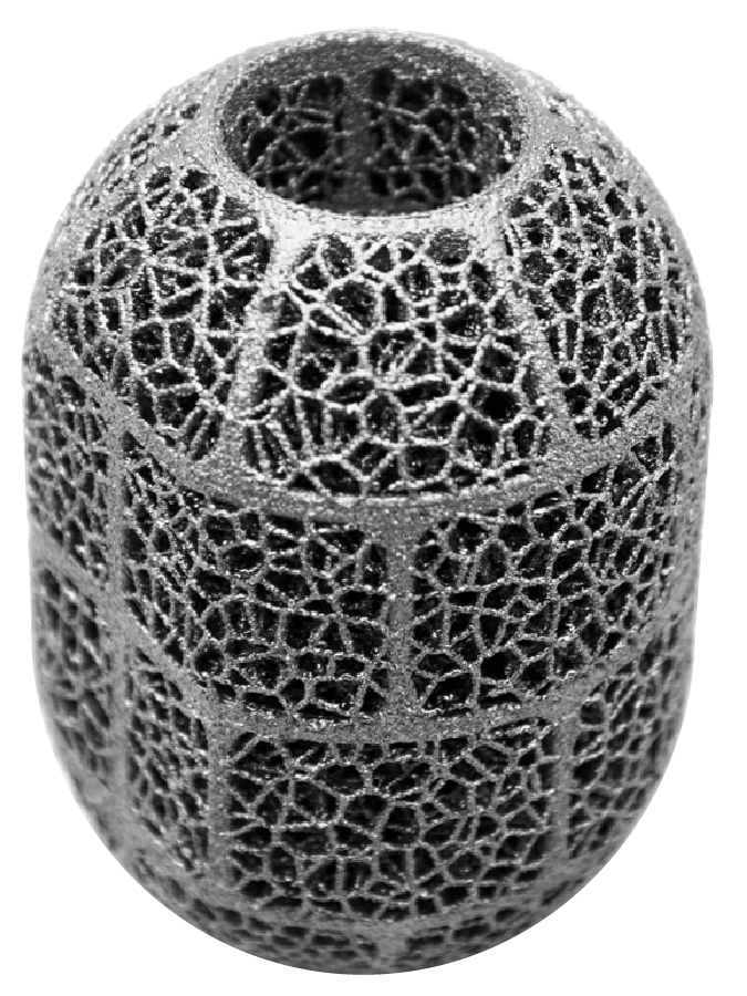Patient-Matched Ankle Fusion Cage