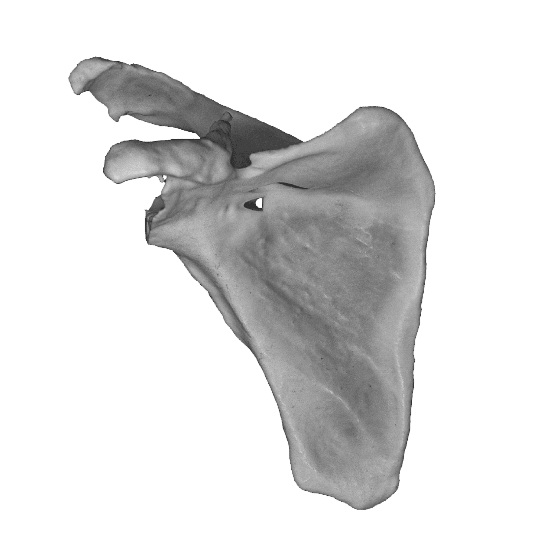 Patient-Specific Shoulder